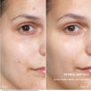 400698_Doctor-BABOR-ampulių-rinkinys-su-retinoliu-Retinol-Ampoul_