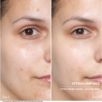 400698_Doctor-BABOR-ampulių-rinkinys-su-retinoliu-Retinol-Ampoul_2
