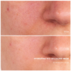 401144_BABOR-Greito-poveikio-drėkinanti-lakštinė-kaukė-Hydrating-Bio-Cellulose-Mask_3